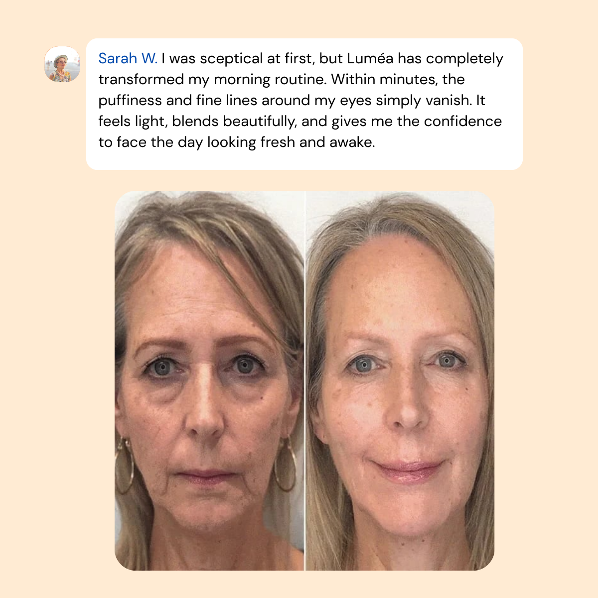 Zenvira Luméa™ - Instant Confidence for Your Eyes