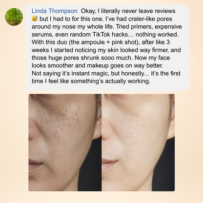 RenewDuo™ Needle-Free Age-Defying Treatment