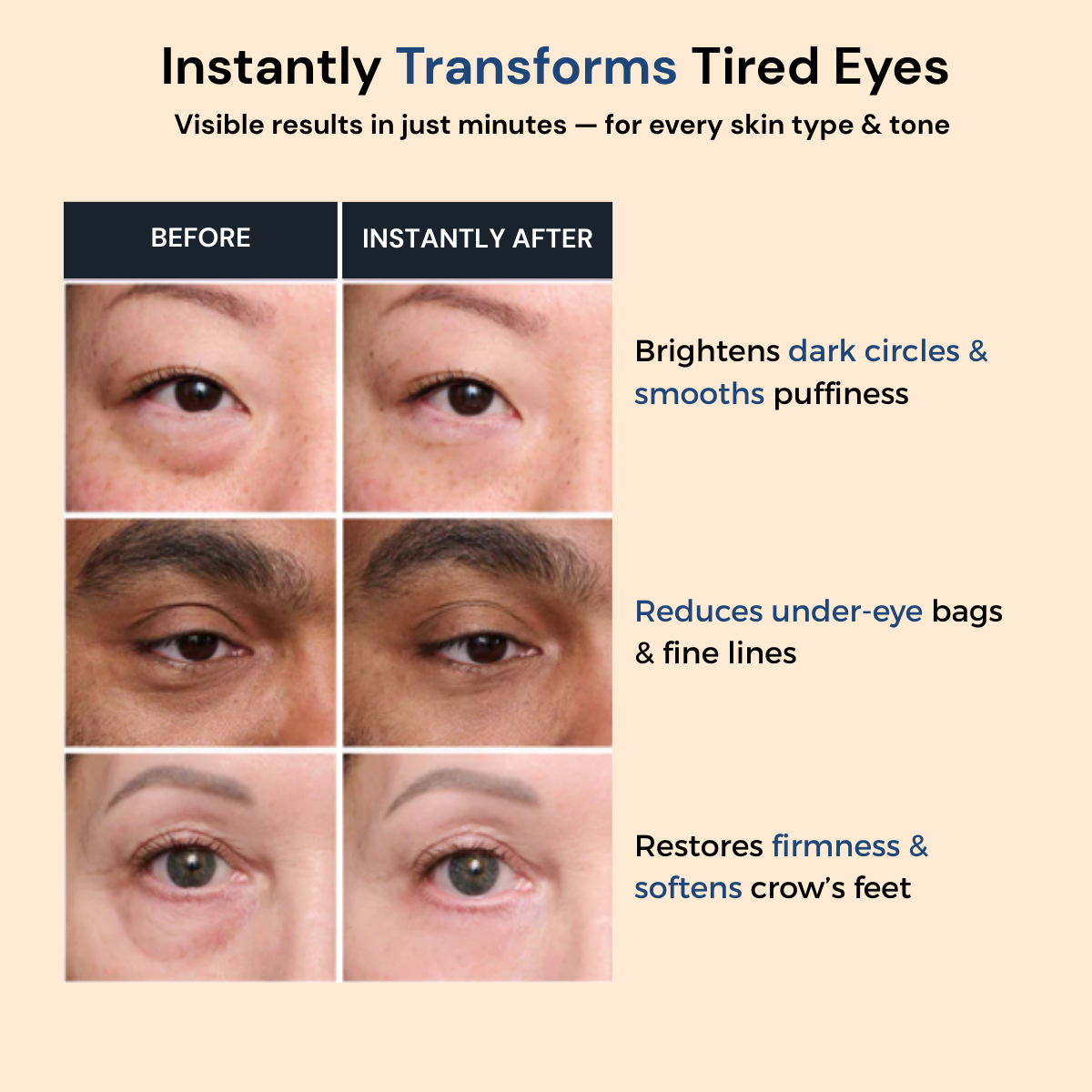 Zenvira Luméa™ - Instant Confidence for Your Eyes