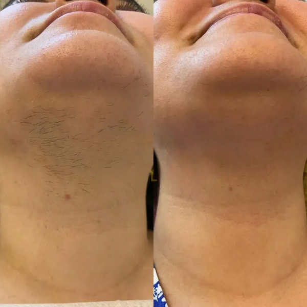 Customer photo