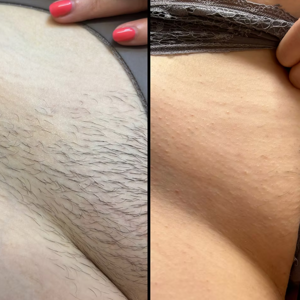 Customer photo