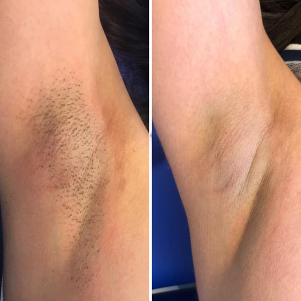 Customer photo