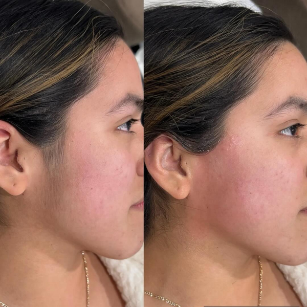Customer photo