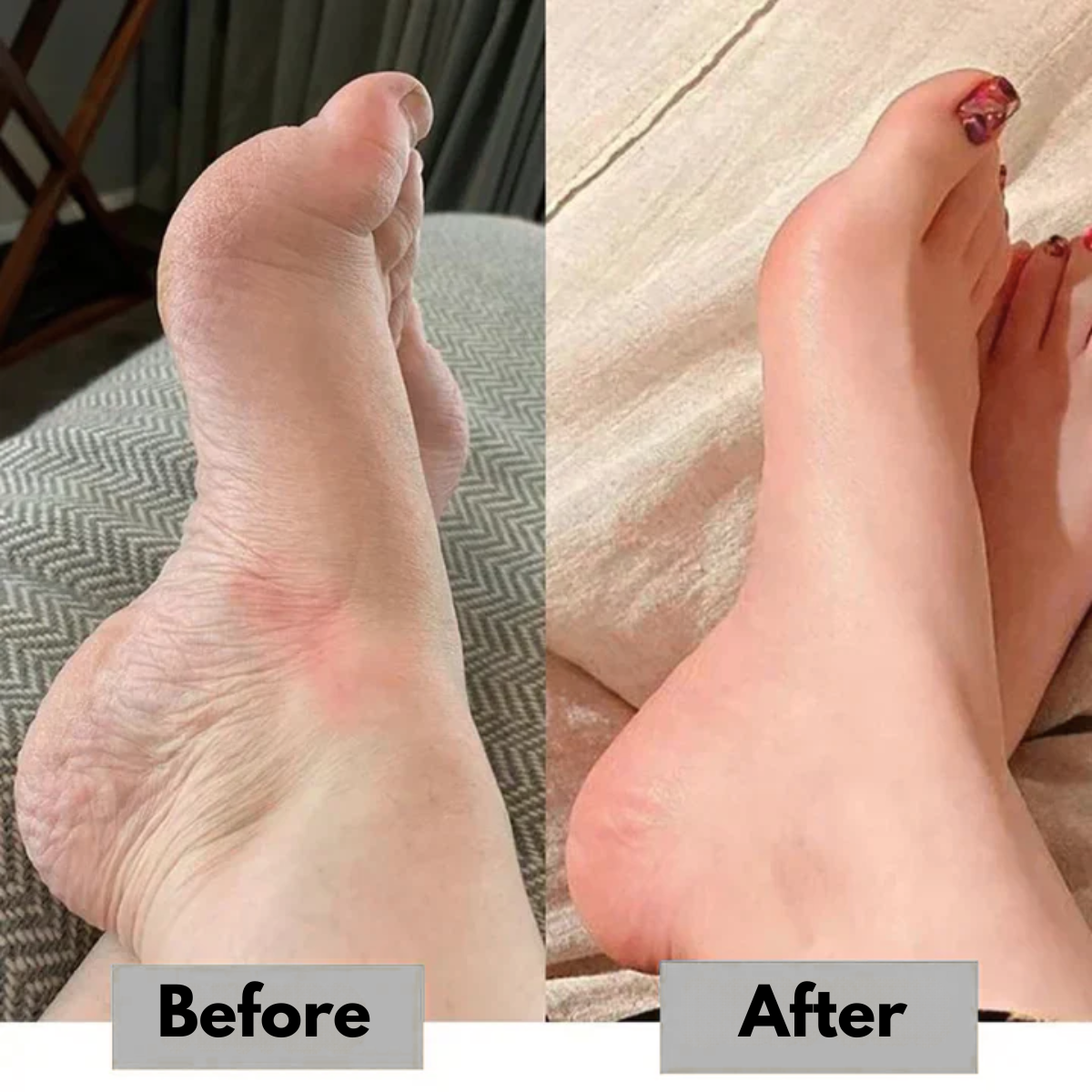 CircuWave™ EMS Massager Foot