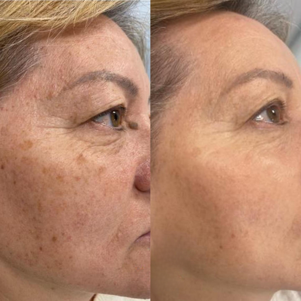 Customer photo