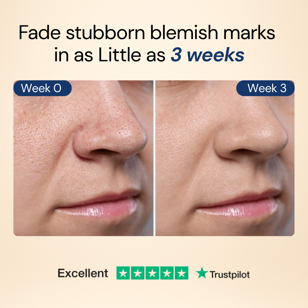 RenewDuo™ Needle-Free Age-Defying Treatment