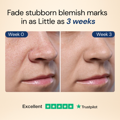 RenewDuo™ Needle-Free Age-Defying Treatment