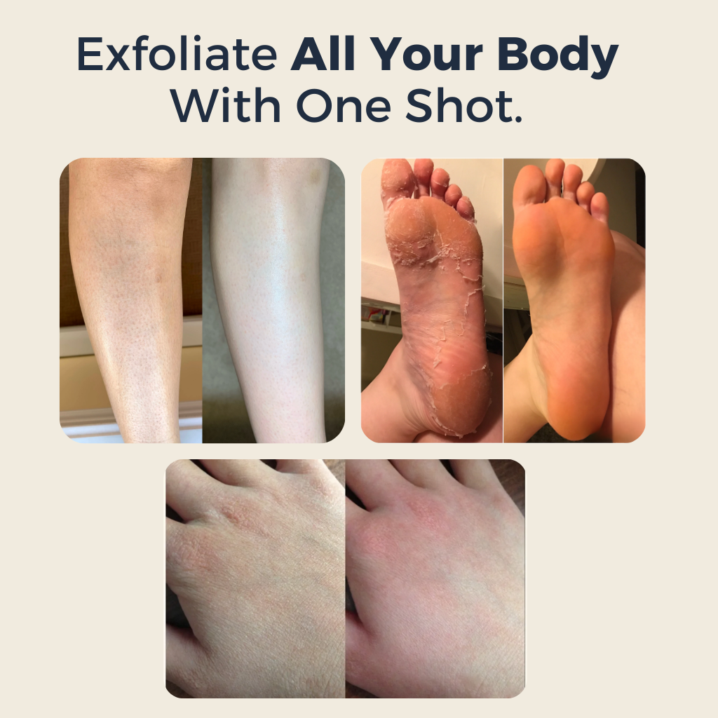 Zenvira PediShot™ - Body Exfoliating Rice Shot Ampoule