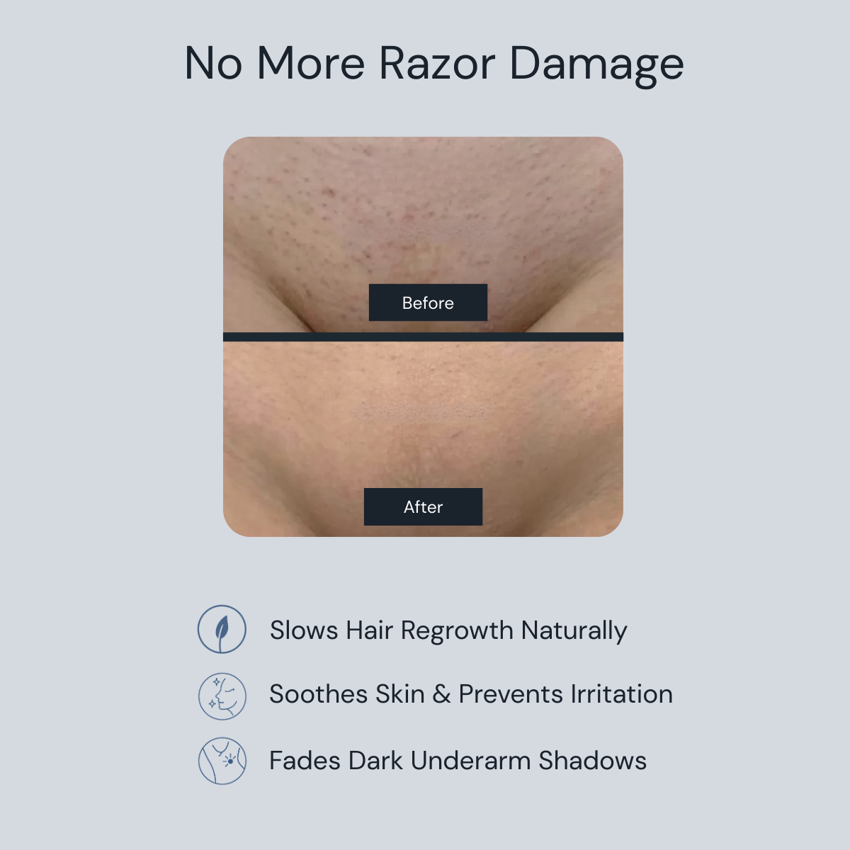 Zenvira Cyperus™- Smooth Skin Zero Pain