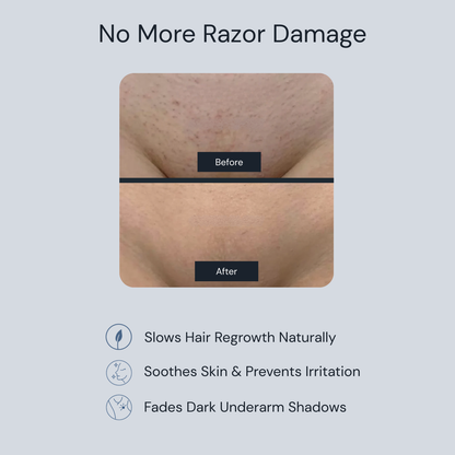 Zenvira Cyperus™- Smooth Skin Zero Pain